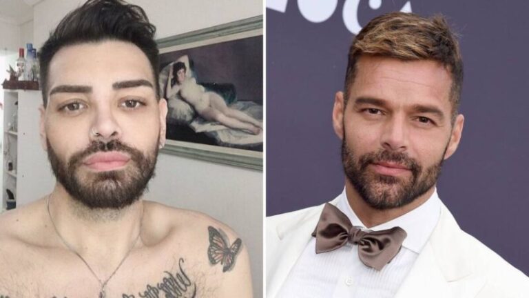 Se ha operado 30 veces para parecerse a Ricky Martin y no lo logra