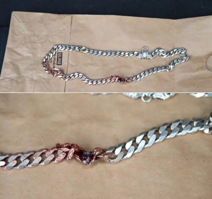 Collar le salva la vida hombre en EEUU