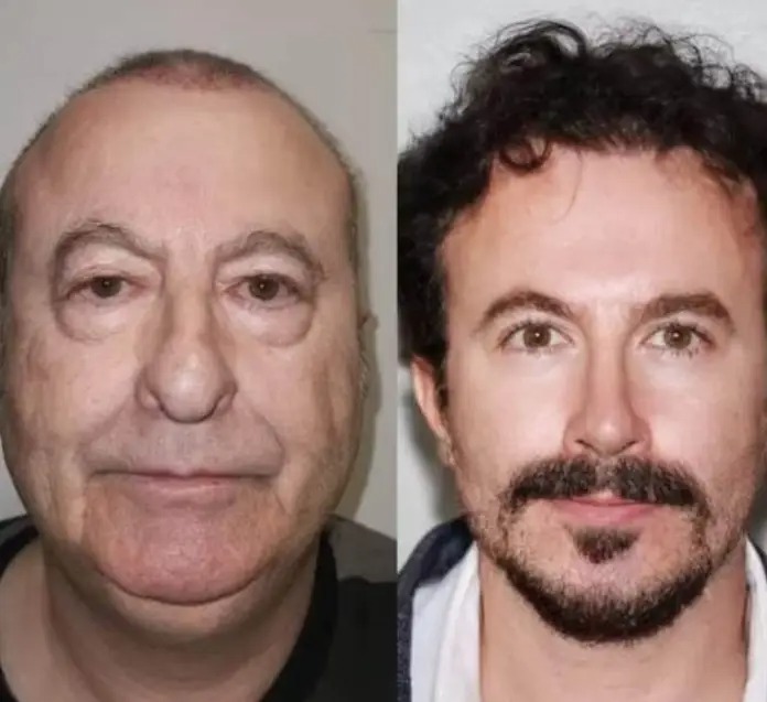 Clínica Estética enciende las redes sociales por cirugías increíbles