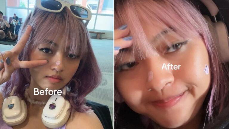 Se inventa una enfermedad para no trabajar y se encuentra al jefe