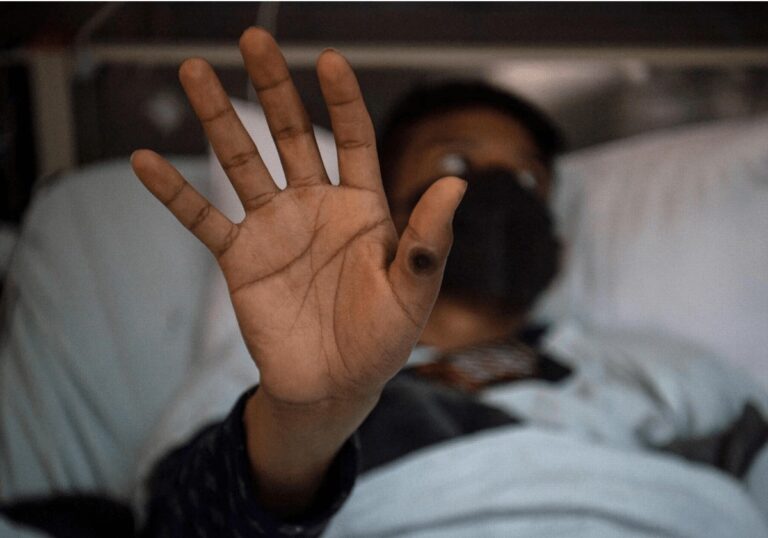 Confirman primer caso de la Viruela del Mono en Tailandia