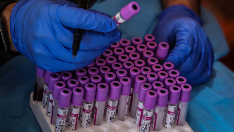 Argentina registra un aumento de casos de sífilis en los últimos años