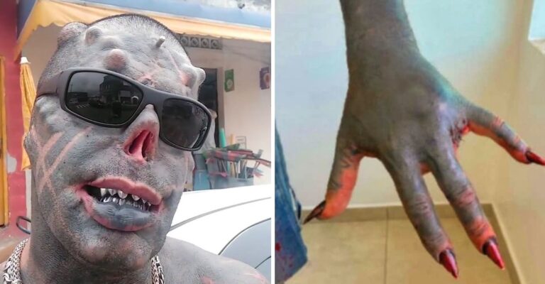 Se amputa algunos dedos de la mano para modificar su cuerpo