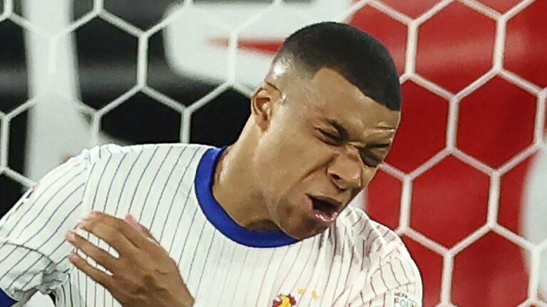 Mbappe sufre fractura de nariz en partido vs Austria