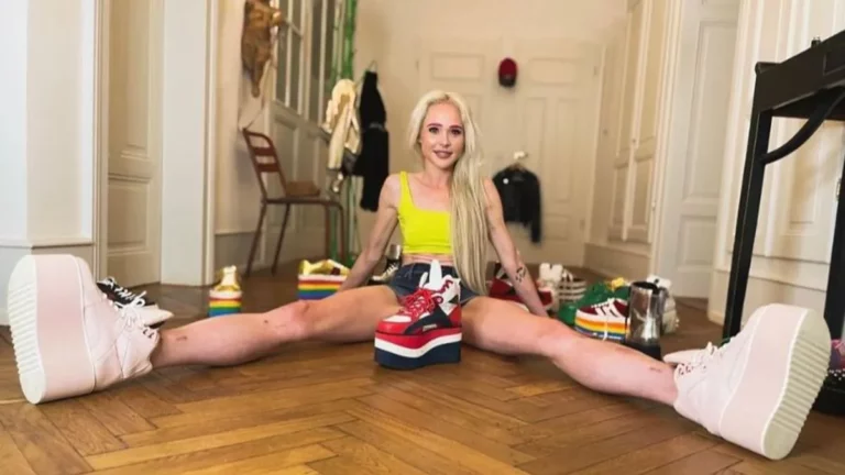 Comentario negativo de su marido la obliga a operar sus piernas