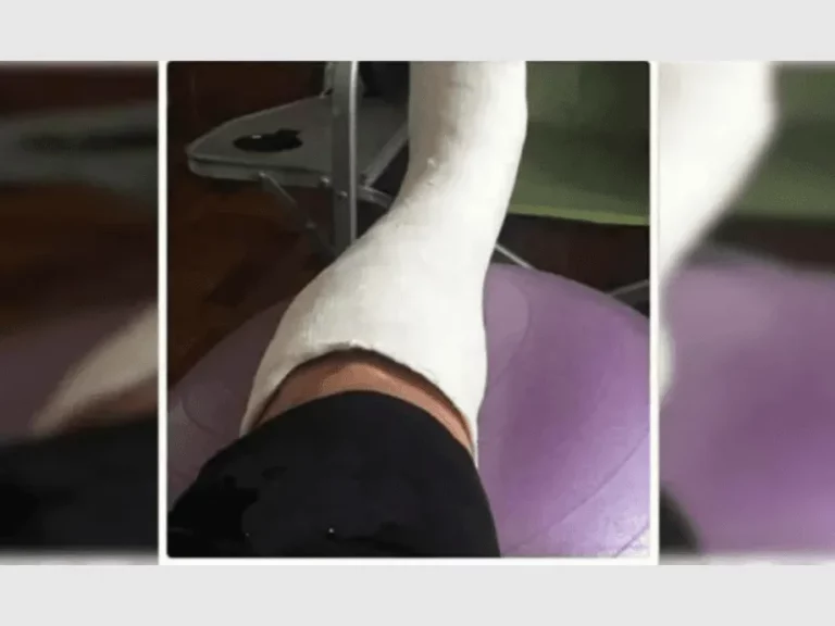 Ofrecen yeso para faltar al trabajo y disfrutar del Mundial de Qatar